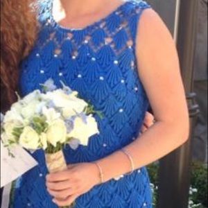 Lily Pulitzer blue scallop lace dress